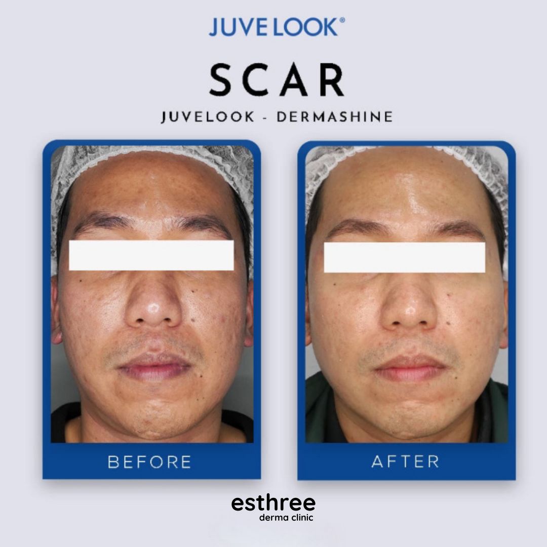 33ee84b9-3847-4bf3-a61b-c381b26d31b6